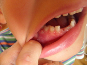 Babské rady na zubní váček